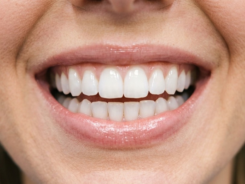 A radiant white smile with healthy teeth